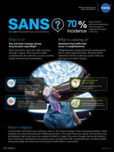 spaceflight-associated-neuro-occular-syndrome-sans-infographic