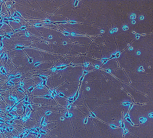 A microscopic view of a network of cells with branching filaments illuminated in bright blue against a dark background.